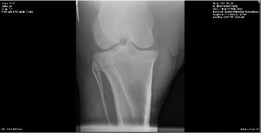 Left Stifle Caudal Cranial